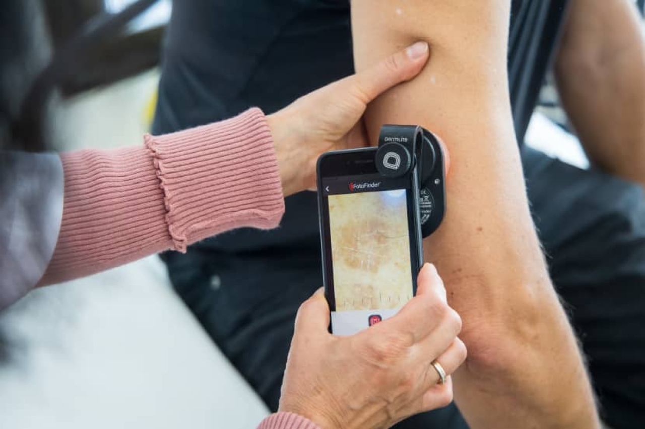 DERMATOVENEROLOGIJA, DERMATOLOŠKA ONKOLOGIJA TE ZAHVATI