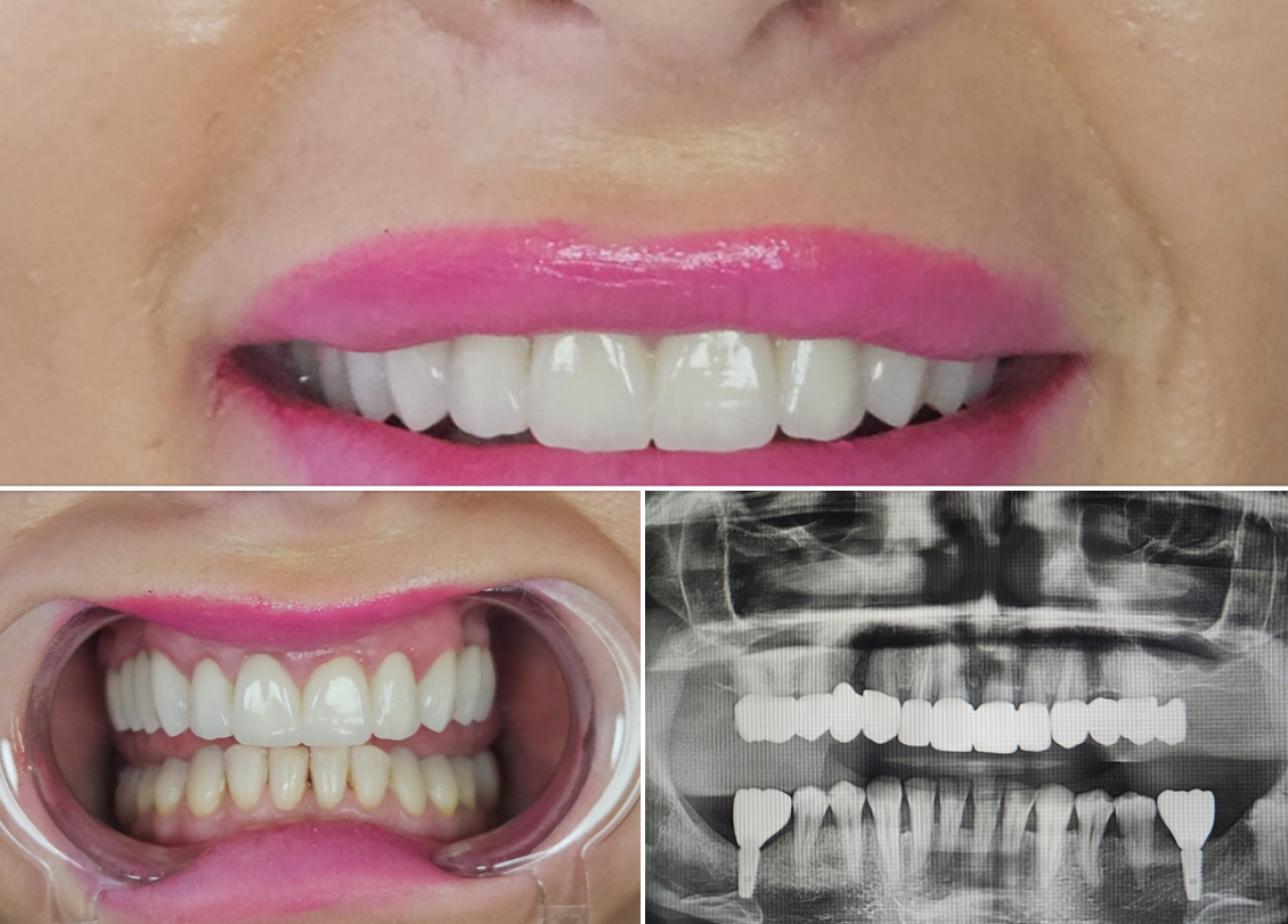 STUDIO DENTISTICO DENTAL CREPULJA, ABBAZIA