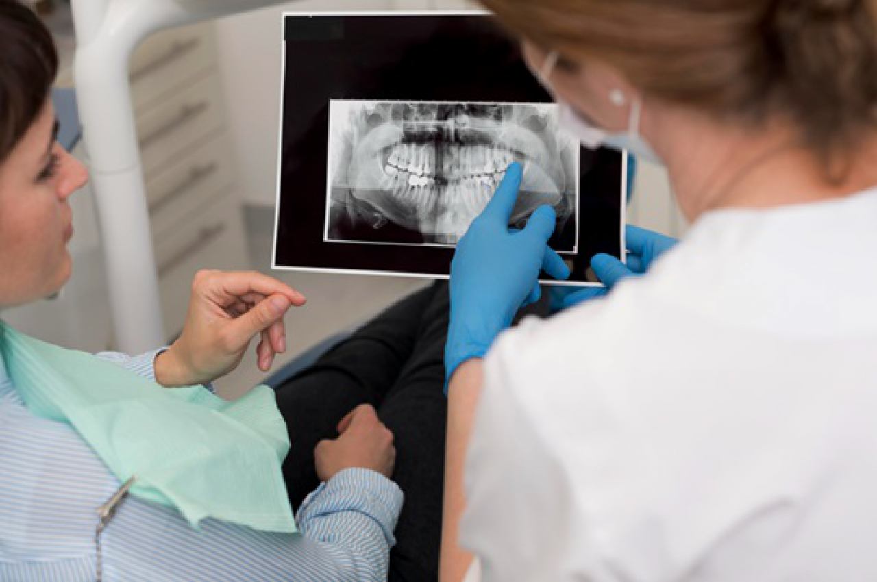 DENTALNI RENDGEN