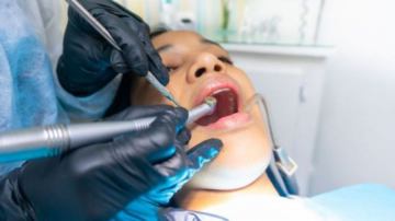 Ugradnja zubnih implantata