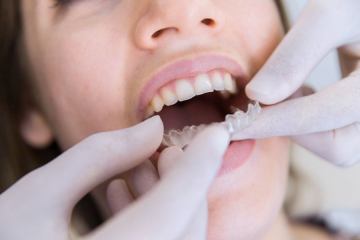 Ortodonti Poreč 